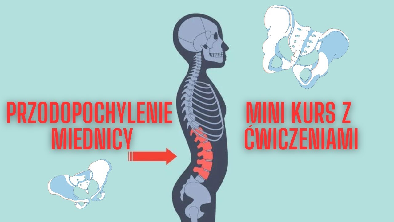 przodopochylenie-miednicy-mini-kurs-z-wiczeniami-youtube