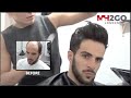 Hair Replacement FITTING VIDEO – Hair loss, Baldness, Hair Wigs, Hair Toupees, Hair pieces