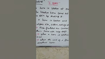 PhysicalEducation#TypesOfBoneInjuries#Fractures#Cls-12#Ch-7#Youtubeshorts#Aroracoaching