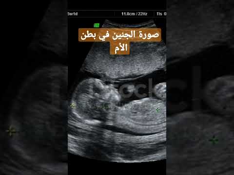 صورة الجنين في بطن الأم