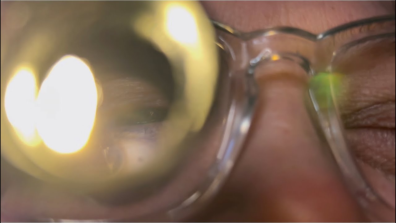 Tingly Hospital Bed POV Up VERY CLOSE ASMR Cranial Nerve Exam for Tingle Immunity w/ Camera Touching