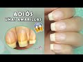 ¿Cómo blanquear uñas amarillas? Causas, Remedios Caseros y Prevención - AdriMani