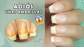 Cómo blanquear uñas amarillas? Causas, Remedios Caseros y Prevención -  AdriMani - YouTube