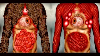 3D ASMR Bee Poison Infected Chest & Bee Sting Therapy &Severely Injured 3D Animation