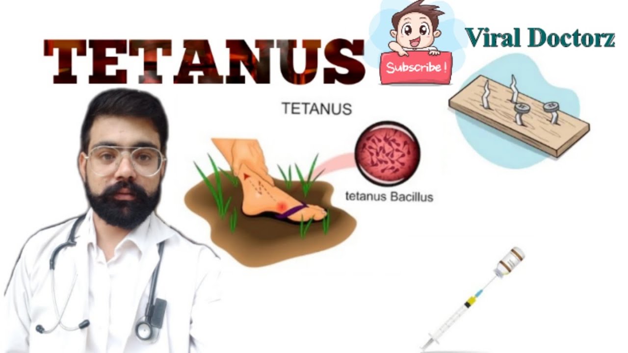 Tetanus(Lockjaw) Causes, types,Symptoms,Diagnosis,Treatment/Hindi