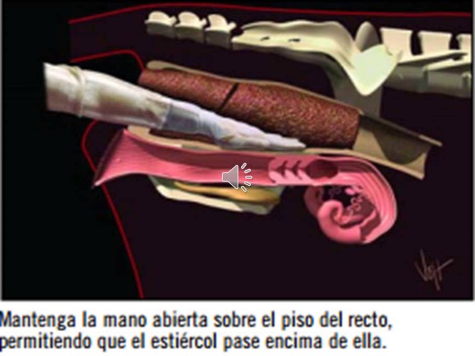 Reproduccion 2; Inseminación Artificial