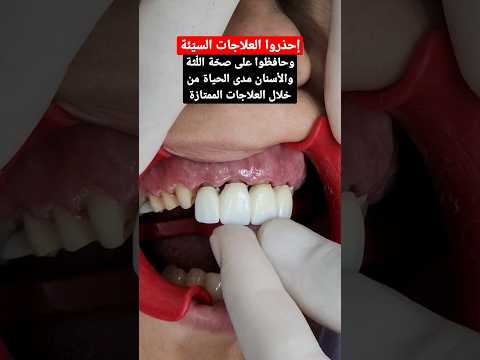 فيديو: كيفية إلغاء شحذ أسنان الكلب؟