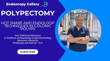 Step-by-Step Polypectomy | EMR • HSP • ENDOLOOP™
