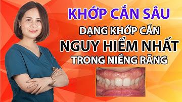 Chẩn đoán khớp cắn sâu | Hậu Quả Cắn Sâu | Tiêu chuẩn kết thúc ca niềng răng