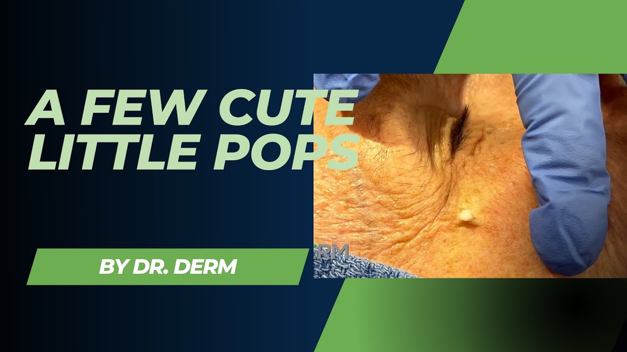 Cute Pimple Pops 2023 video