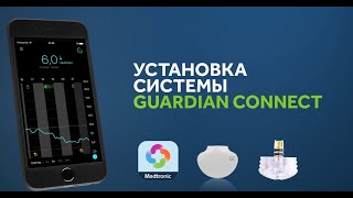 Установка Guardian Connect