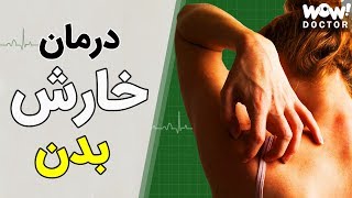 چجوری خارش بدن را درمان کنیم ؟