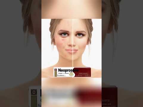 منتج Neoprosone كريم صابونة الاصلية عصاره نيوبروسين المعالجة الكلف المنشأ هندي ورجعت توفرت