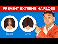 Prevent Extreme Hair Fall and Regrow Your Hair | HAIR FALL , ALOPECIA AND BALDNESS - Dr. Vivek joshi