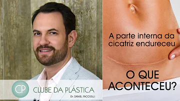É normal sentir pontada na cesárea?