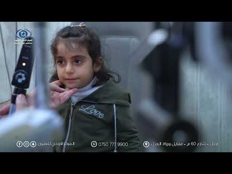 علاج الحول للاطفال مع الدكتور رائد شطناوي في المركز الاردني للعيون اربيل