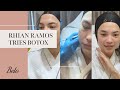 Rhian Ramos Tries BOTOX on Her Masseter Muscles! | Belo Medical Group