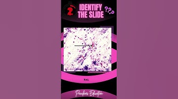 Identify The Slide! | Pathology Slides | #neetpg #fmge #inicet #pyq #pathology