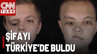 Yüz Gelişim Bozukluğu Olan Kazakistanlı Nikita İstanbul'da Ameliyat Oldu