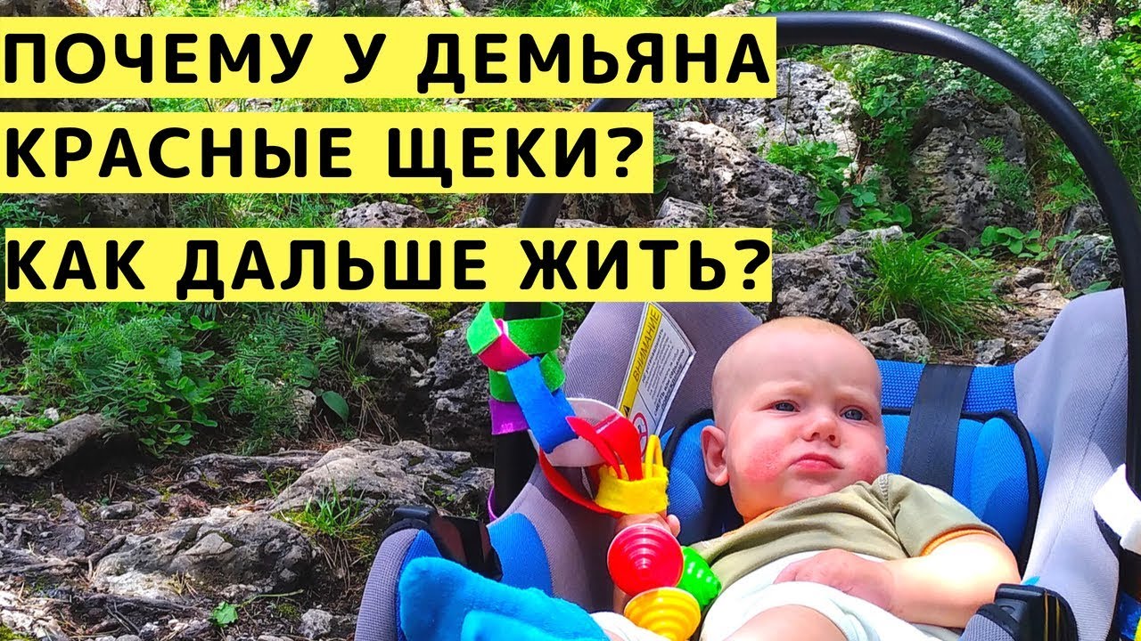 Почему у Демьяна Красные Щеки и Как Дальше с Этим Жить