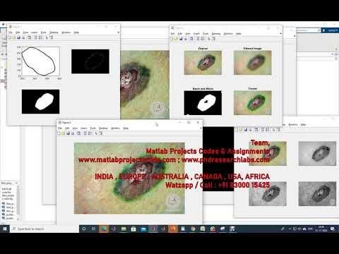 PH.D. RESEARCH SUPPORT | MATLAB PROJECTS | WWW.MATLABPROJECTSCODE.COM | WWW.PHDRESEARCHLABS.COM
