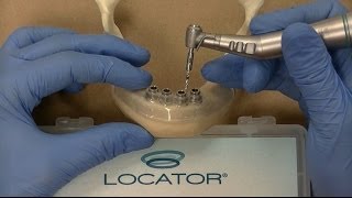 Zest LODI Mandibular Guided Surgery Demonstration / Technique