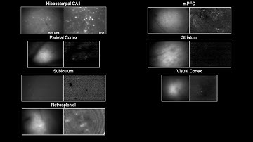 Example Miniscope recordings from different brain regions