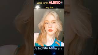 Si cantik Albino Anindhita Asmarani