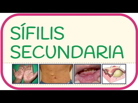 SÍFILIS SECUNDARIA - Fisiopatología, alteraciones en la piel, manifestaciones clínicas