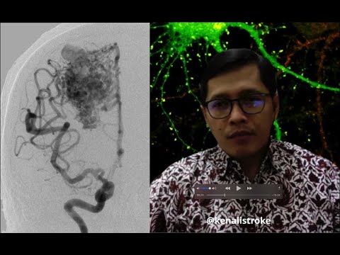 Video: Malformasi Vena Cutaneo-mucosal Muka Boleh Berkembang Secara Mutasi Mutasi Gen TEK Tetapi Mungkin Dikaitkan Dengan Ekspresi Berlebihan Src Dan P-Src