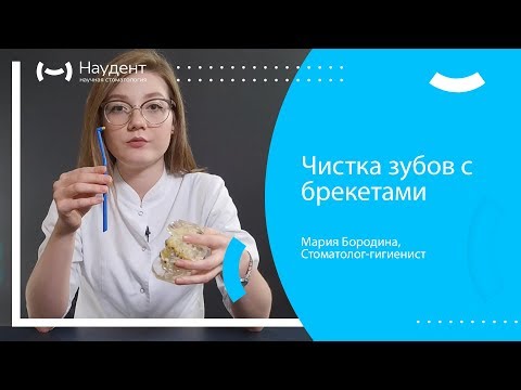Чистка зубов с брекетами