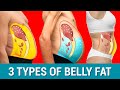 The 3 Belly Types: WHICH ONE DO YOU HAVE?