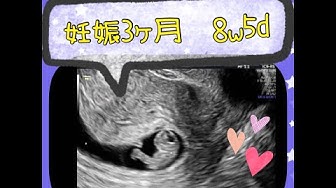 妊娠8週 Youtube
