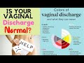 Vaginal Discharge| Types| Treatment| White Vaginal Discharge| Explained