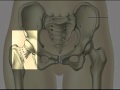 Osteoporoz Nedir?