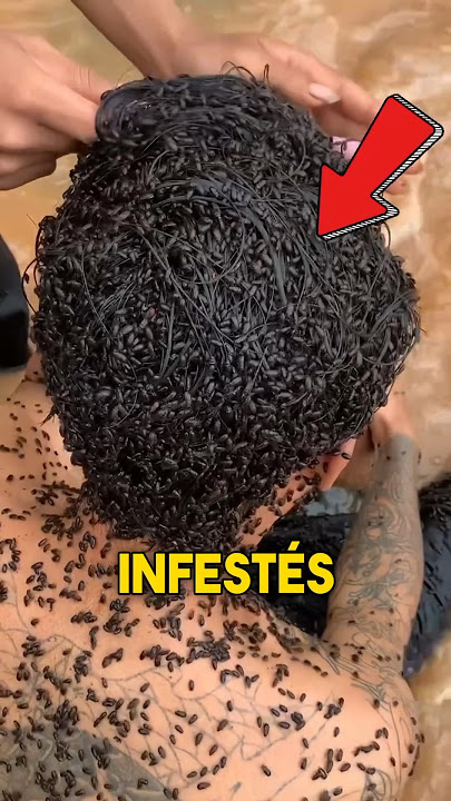 Quels Sont Ces Insectes EFFRAYANTS Dans Leurs Cheveux ? 😨