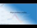 Myocardites virales c bouleti reanimation2021