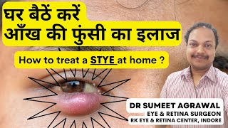 How To Treat A Stye At Home ? घर पर कर आख क फस क इलज L