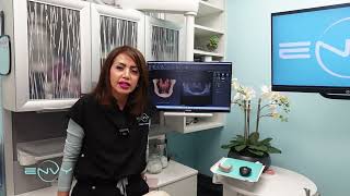 What Are Mini Dental Implants? The Permanent Fix for Loose Dentures