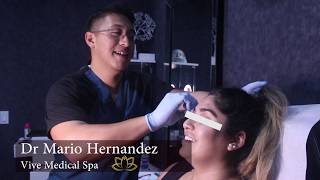 Baby Botox en Tijuana I Prevencion de Arrugas I Dysport Opcion en Tijuana