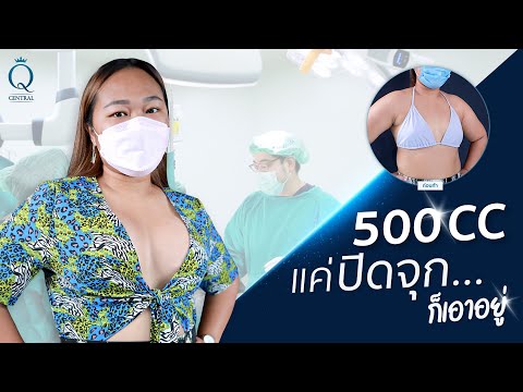 รีวิวเสริมหน้าอก 500cc แค่ปิดจุก ก็เอาอยู่