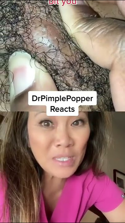 Dr Pimple Popper Needs a SPLASH SCREEN! #DPPReacts
