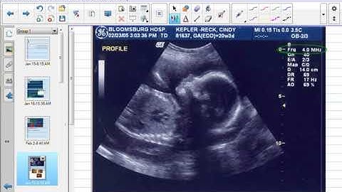 Physics 12.1-12.2 Sound