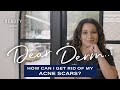 How Can I Get Rid Of My Acne Scars? | Dear Derm | Well+Good