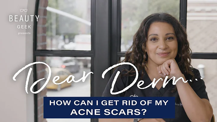 How Can I Get Rid Of My Acne Scars? | Dear Derm | ...