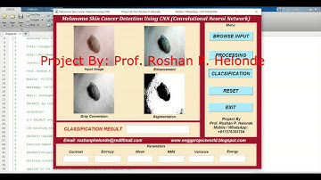 Melanoma Skin Cancer Detection Using CNN Convolutional Neural Network | Project With Source Code