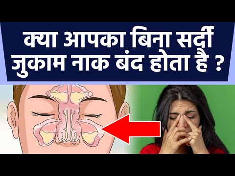 वीडियो: अपनी नाक में कोल्ड सोर का इलाज कैसे करें: 13 कदम (चित्रों के साथ)