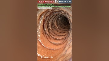 Intestines Slowed by Sitting Long Hours Animation | Gut Health | Human Anatomy | Stomach AI Art | 08