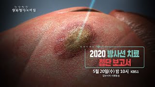 [생로병사의 비밀] 732회 (20.05.20) 2020 방사선 치료 첨단 보고서 예고