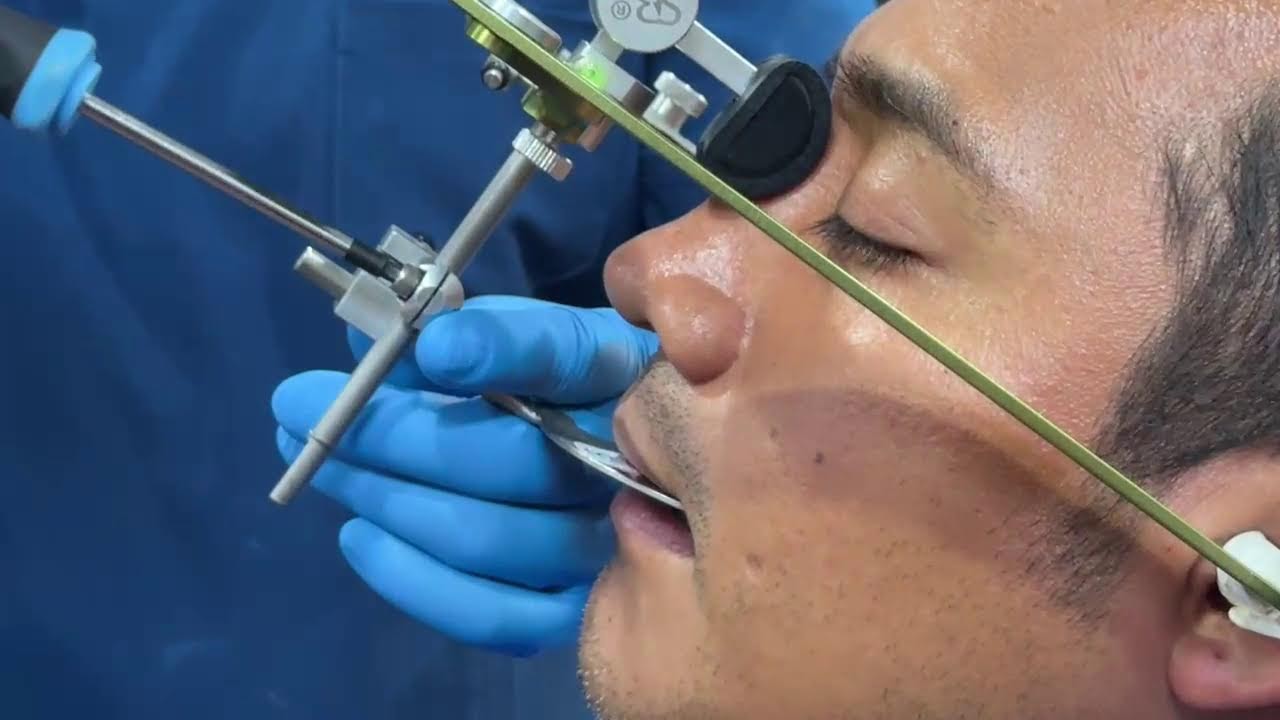 Uso correcto del articulador, semi ajustable